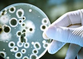 Nhiễm khuẩn HAIs là gì? Tác nhân gây hại của nhiễm khuẩn HAIs do đâu?